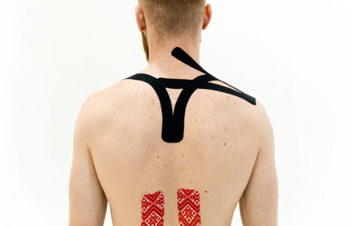 Bandajare neuromusculara